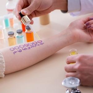 Braço de mulher com marcas para fazer teste de diagnóstico de alergias
